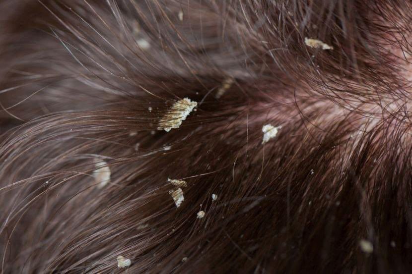 theiceraf's tweet photo. Lahh baru tahu guna coconut oil ni, kelemumur susah nak melekat kat rambut. Korang yang mana ada masalah ni, serious membantu weihhh 😭😭 https://t.co/Tc3dx0eTAb