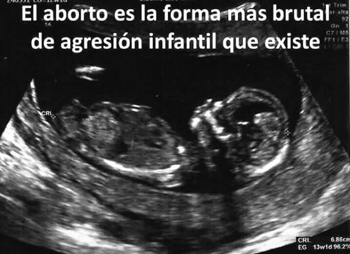 El #aborto es la forma más brutal de agresión infantil que existe. 
#SiAlaVida