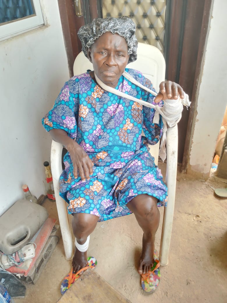 Ezydammy's tweet photo. This poor widow was brutalized and banished from her village in Owoahiafor I Obingwa LGA, Abịa State on accusations that she's a witch.
Please help @alexottiofr @DammyFrancos @UjuAnya @ruffydfire @ernestubani @DavidHundeyin @HenryShields https://t.co/AzpXtOVyYw