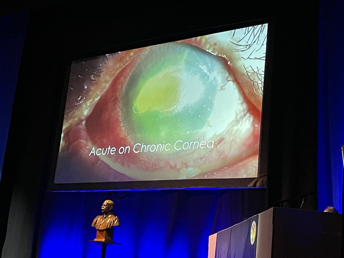 Next in our Emergency Ophthalmology Session, corneal acute cases with Ankur Barua. #OOC2024