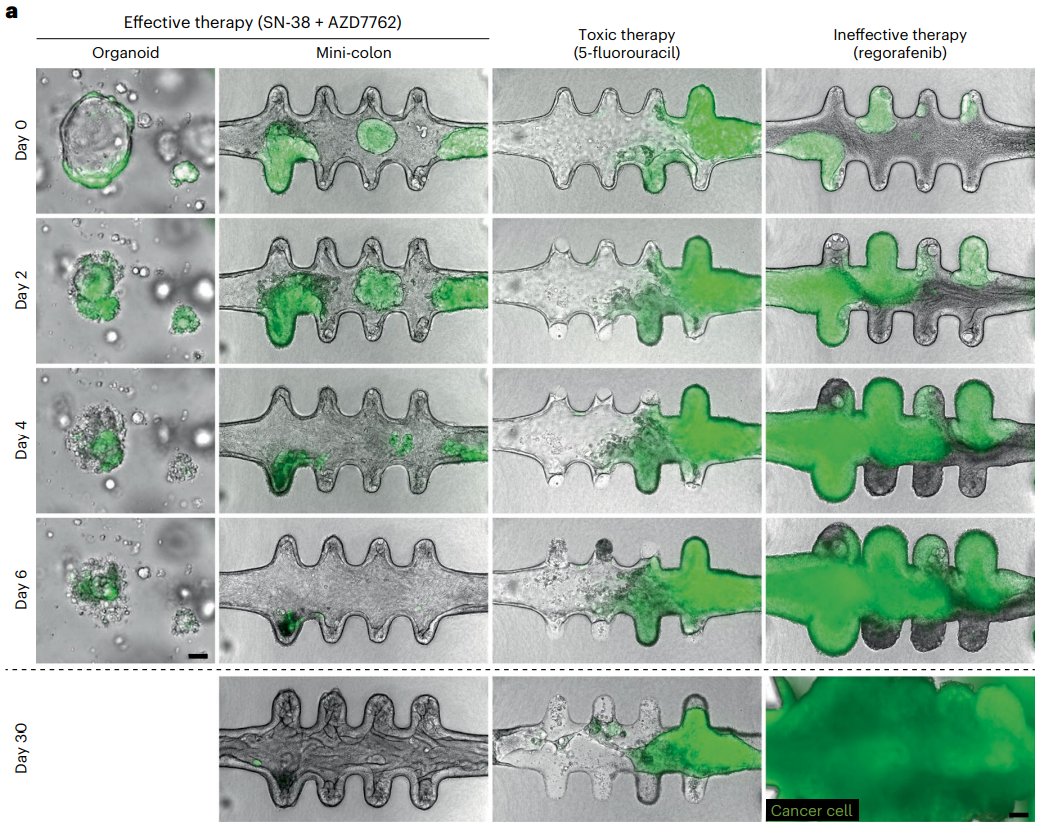 DrSamuelBHume's tweet photo. This is extremely cool: 'mini-colons' to mimic the structure of the colon and to study cancer 

They're built from patient cells, so can be used to test drugs - both efficacy to kill cancer cells (shown in green) and toxicity to healthy cells:
The mini-colons seem have a number of benefits over conventional organoids: a structure that matches colon tissue, longer-term culturing, and a closer replication of the tumour microenvironment

Lorenzo-Martín et al. in Nature Biotech (https://t.co/dSe29AHIBQ)