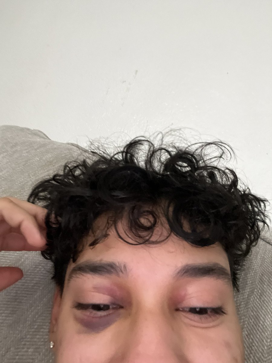 ycgrom's tweet photo. it’s not even noticeable https://t.co/C7awcnskTd
