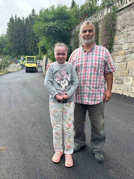 Trabzon'da kelebek hastası olan ve toza maruz kalmaması gereken Ayşenur için 120 metrelik yol asfalt ile kaplandı.