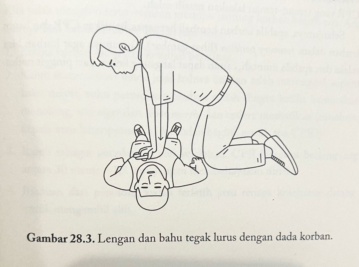 afrkml's tweet image. 5. Henti Jantung
Prinsip Dasar: Kenali dulu tanda2 Henti Jantung!

Caranya:
1. Cek respons orangnya dulu, pastiin dia gak sadar.
2. Panggil bantuan secepetnya.
3. Pastikan henti jantung!
Catatan:
Penolong awam tidak terlatih ga dianjurkan memeriksa nadi karotis krn berisiko…