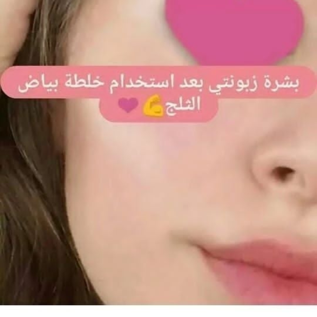 arvea_push_up's tweet photo. #النوماس_محمد_سمير_الذيابي https://t.co/wsXT4yc2V7