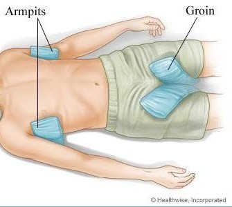 afrkml's tweet image. 7. Demam
Prinsip: Kompres &amp;amp; jaga hidrasi.

Langkah pertolonggan:
1. Cek suhu dulu dengan termometer (WAJIB!)
2. Meriang --&amp;gt;37,5 C: Perbanyak minum+kompres anget di ketek (bukan di jidat!)
3. Demam --&amp;gt;38 C: Tambah obat penurun demam
4. Banyak minum air biar gak dehidrasi
5. Pakai…