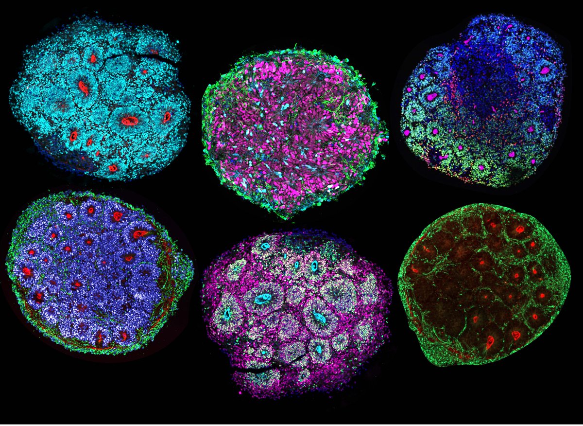 HSCRB (@hscrb) on Twitter photo A revolutionary new platform, relying on what researchers in the <a href="/ArlottaLab/">Arlotta Lab</a> are calling ‘brain chimeroids’, offers a unique opportunity to understand how the human brain reacts to various stimuli. hscrb.harvard.edu/news/brain-chi… A revolutionary new platform, relying on what researchers in the <a href="/ArlottaLab/">Arlotta Lab</a> are calling ‘brain chimeroids’, offers a unique opportunity to understand how the human brain reacts to various stimuli. hscrb.harvard.edu/news/brain-chi…