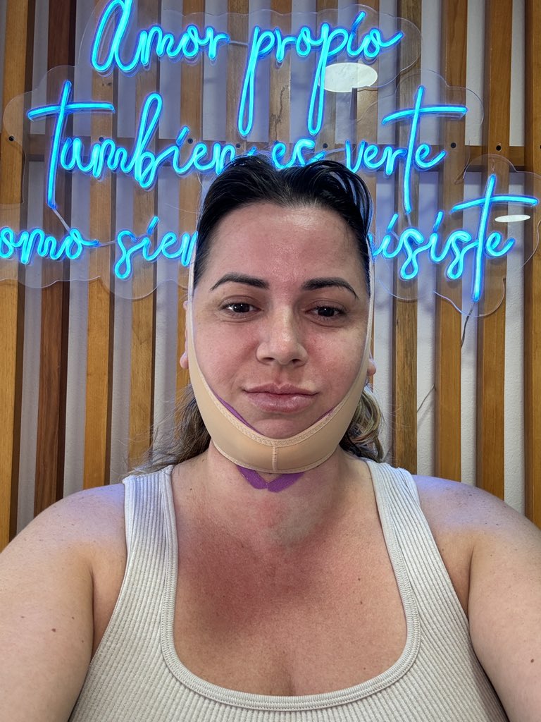 IamMsJasmine699's tweet photo. I’m so excited to see these results in a few days. A little facial tune up to snatch my jawline and neck. lol 😂 this shit is ridiculous frfr #faceSwollen https://t.co/a5f9Q6EfME