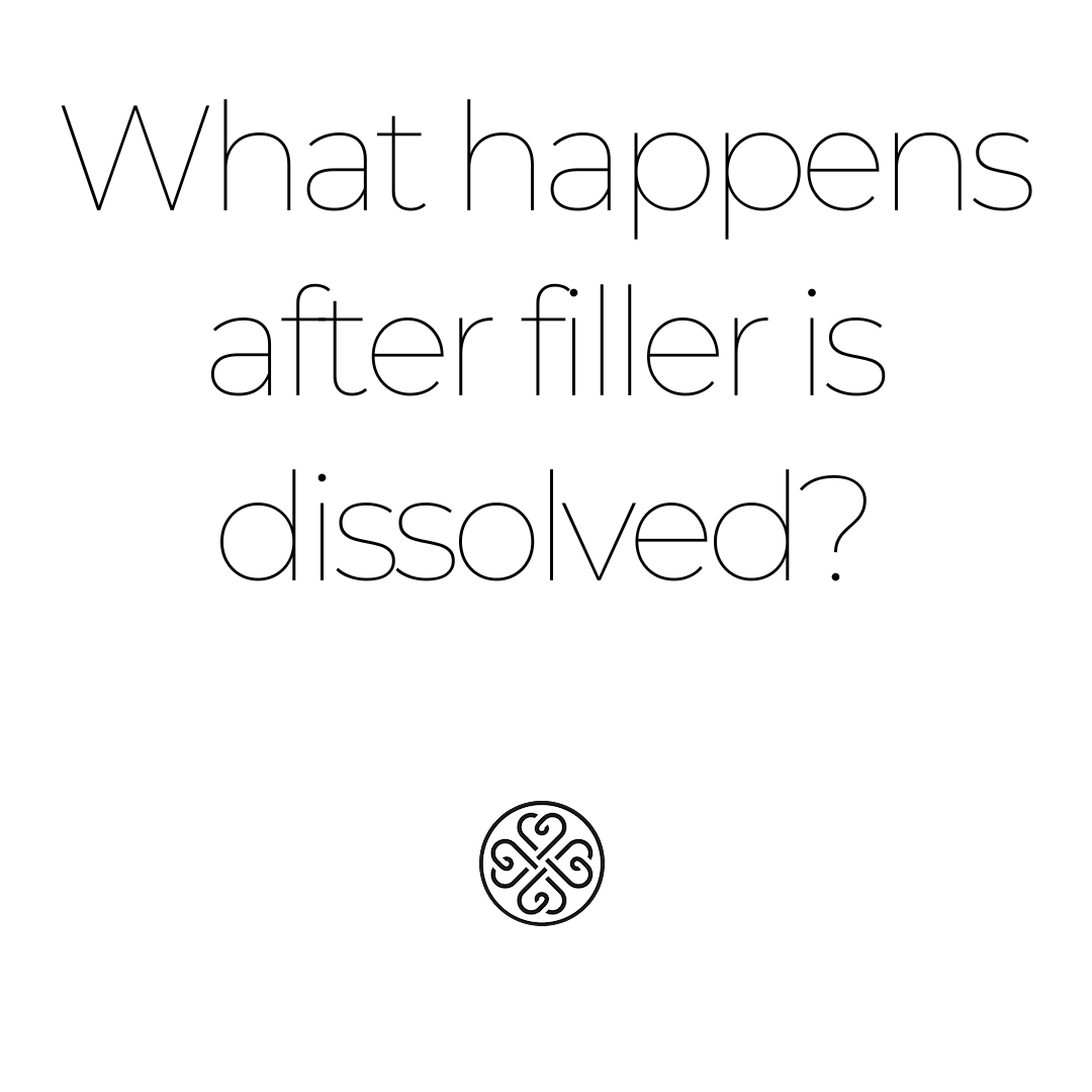 When dermal fillers are dissolved, typically using an enzyme called hyaluronidase for hyaluronic acid-based fillers, several things happen including:

Possible Side Effects: Temporary side effects may include swelling, bruising, and allergic reactions.
