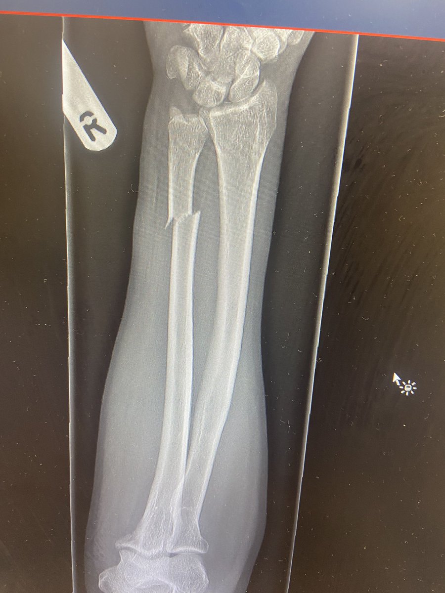 I shall present these images which in no way relate to the new horse and a fence post… Wife not best pleased…