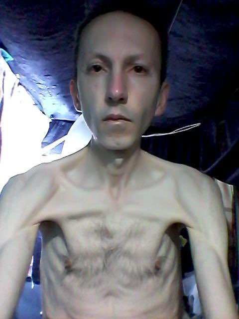 VMehrannia's tweet photo. Ahmadreza has agreed to stop his hunger strike, today, after 8 days. He knows that his body could not stand this hunger strike any longer given two past hunger strikes. He is still very tired of this situation and wants his voice to be heard. https://t.co/H4uVICYP1o