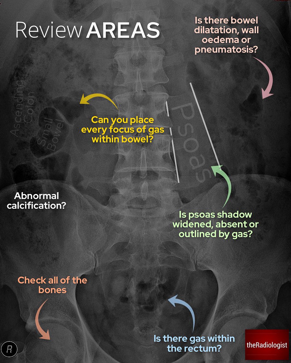 There is some debate regarding the utility of an acute abdo film but in some parts of the world is still a widely used tool 

Abdominal X-Ray anatomy and review areas