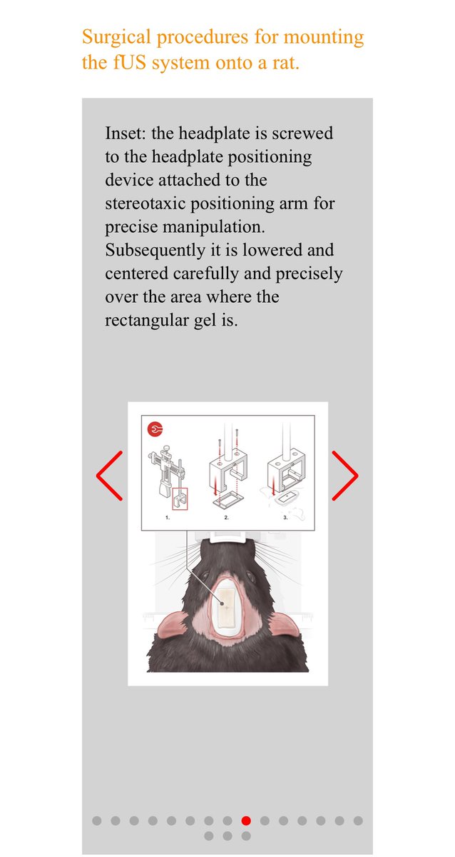 On the website , we  have a very cool IKEA- like guide to do the surgery . Check it out here neuroultrasound.com/methods/1/