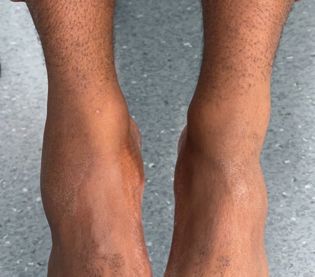 Speed ha estado en Noruega. Su visita ha terminado con una rotura de tobillo, gente tirándole del pelo, subiéndose encima de su coche y agrediendo a su equipo

Hilo con todo lo ocurrido