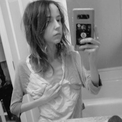 PixieStrmDesign's tweet photo. 5 years ago I signed a power of attorney expecting to die and here I am now still here. Recovery from my eating disorder is challenging but I never want to go back to how I was 5 years ago. From 30 lbs up to 80 lbs. I’m so proud of the progress and can’t wait to see what the future holds! 😊💖