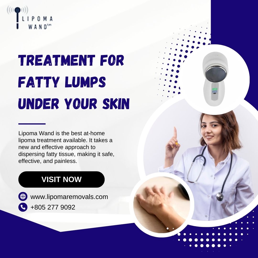 Struggling with fatty lumps under your skin? The Lipoma Wand offers a simple, non-invasive treatment for those bothersome lumps. 

🌐 Visit the website: lipomaremovals.com

📞 Call us: +805 277 9092

#LipomaTreatment #LipomaWand #LipolysisJelly #LipomaRemoval #skincare