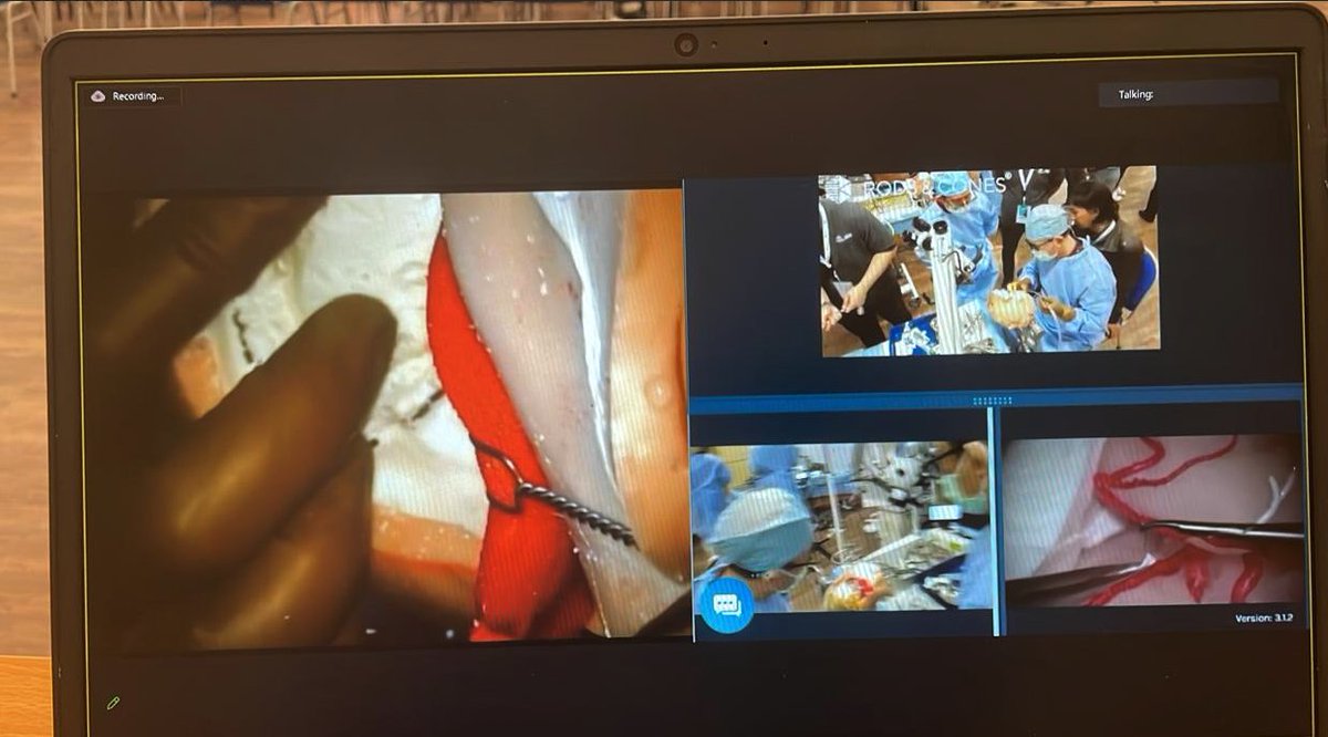 Empowering Neurosurgical Excellence in Indonesia 👉tinyurl.com/y8u8h8hp
<a href="/BudiGSadikin/">Budi G. Sadikin</a> <a href="/BarrowNeuro/">BarrowNeurological</a> #Neurosurgery #MedicalEducation #HealthcareTransformation #StrokeCare #IndonesiaHealthcare #Telepresence #Telementoring #Teleproctoring #Smartglasses