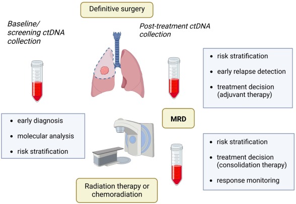 Marco Tagliamento (@m_tagliamento) on Twitter photo In #CancerTreatmentReviews we addressed the use of #ctDNA in localized #NSCLC, including:
🧪Techniques for ctDNA detection
🩸Current main applications
🧬Future directions
Open access: doi.org/10.1016/j.ctrv…
<a href="/AriMarinel/">Arianna Marinello, MD</a> <a href="/FilippoDallOlio/">Filippo Dall'Olio</a> <a href="/BenjaminBesseMD/">Benjamin Besse</a> <a href="/JordiRemon/">Jordi Remon</a> <a href="/OncoAlert/">OncoAlert</a> In #CancerTreatmentReviews we addressed the use of #ctDNA in localized #NSCLC, including:
🧪Techniques for ctDNA detection
🩸Current main applications
🧬Future directions
Open access: doi.org/10.1016/j.ctrv…
<a href="/AriMarinel/">Arianna Marinello, MD</a> <a href="/FilippoDallOlio/">Filippo Dall'Olio</a> <a href="/BenjaminBesseMD/">Benjamin Besse</a> <a href="/JordiRemon/">Jordi Remon</a> <a href="/OncoAlert/">OncoAlert</a>
