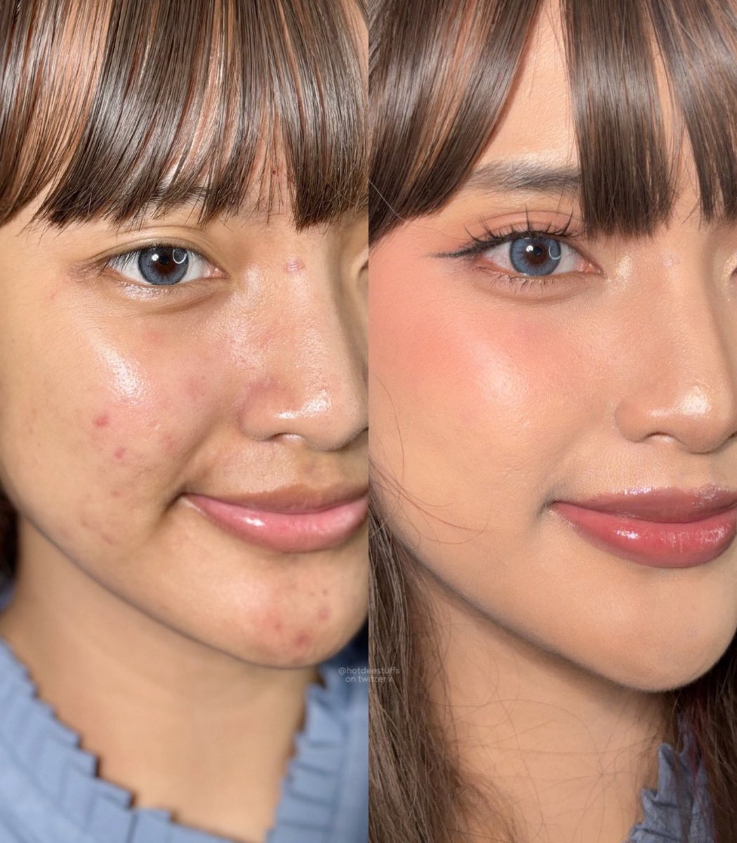 hotdeestuffs's tweet image. Hey, yang punya banyak bekas jerawat + oily 🫵🏻 

Nih cushion yg gak gampang geser, ngesetnya cepet bgt, dan COVERAGENYA FULL, TANDAIN PLS!🥹

Baru kali ini kemakan gimmick sampe beli, ternyata YA EMANG DAHSYATTT wkwk. Skrg paham kenapa orang-orang pada mangap🤣