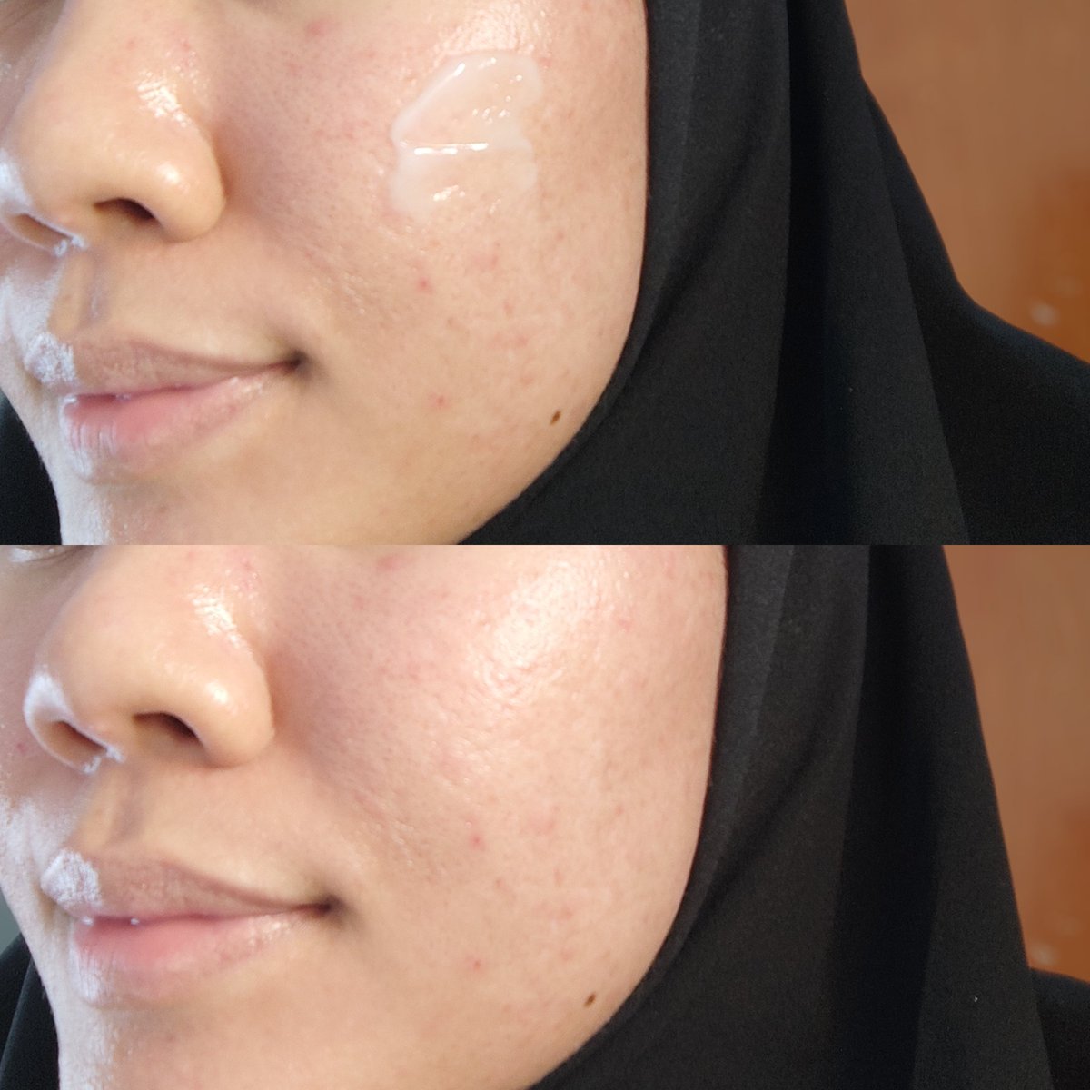 nsvrn_'s tweet photo. Moisturizer yang ringan, glowingnya dapet &amp; tanpa berminyak + kulit bebas acne juga krn ini ada kandungan RetinAlt nya! 💜 #racuninskincare  #azarinebarriermoisturizer https://t.co/hNM22zW3PN