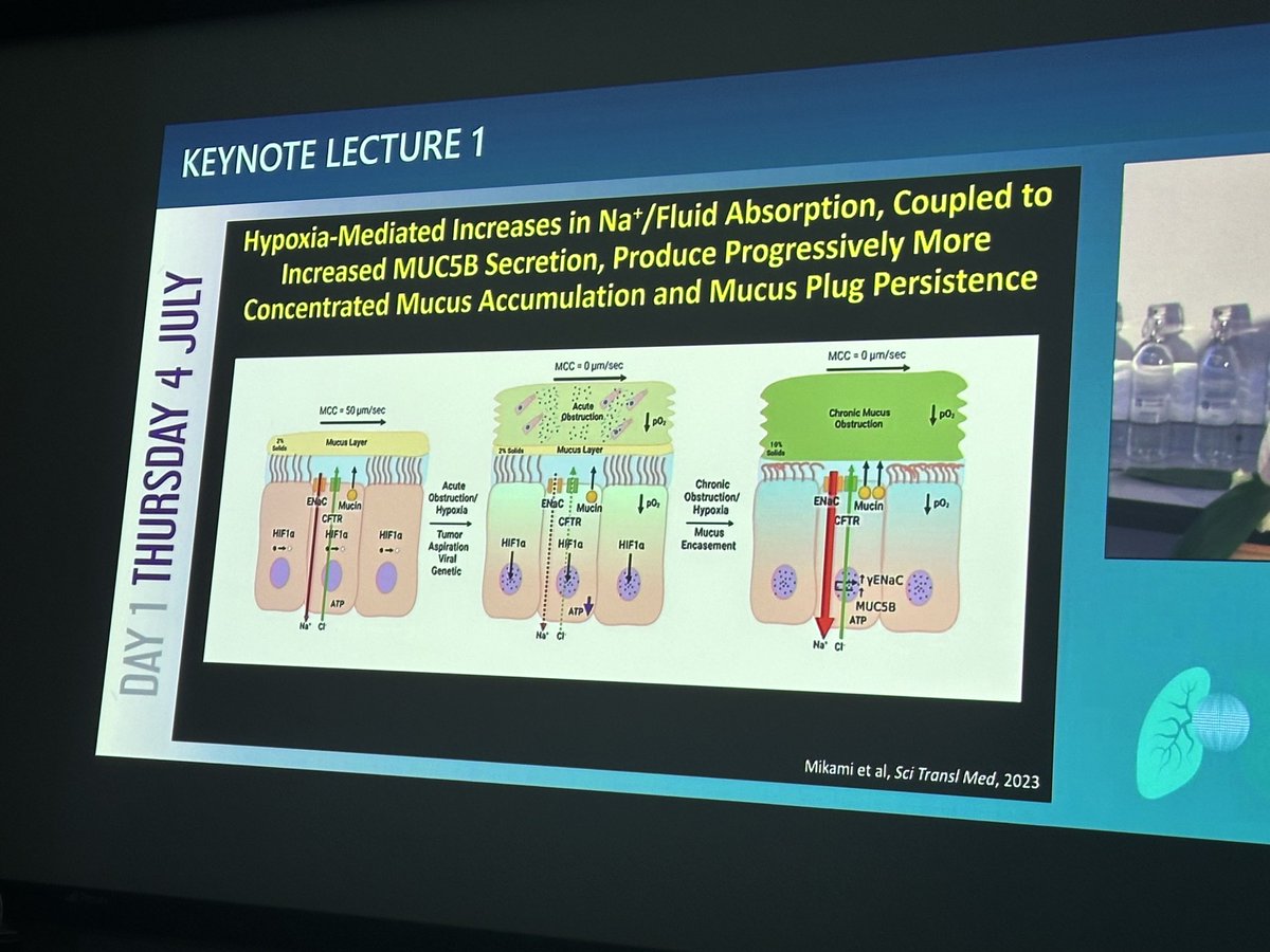 Fantastic talk Rich Boucher on mucus and the need for bronchiolar obstruction causing hypoxia and inflammation causing bronchiectasis #wbc2024