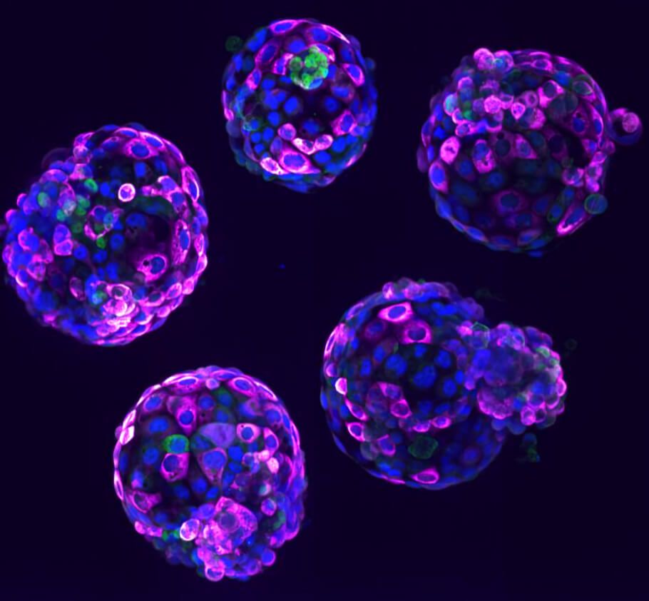 DisabledWorld's tweet image. New Ethical Framework Introduced for #StemCell Based Embryo Research
#CodeofPractice for the Generation and Use of #HumanStemCell Based #Embryo Models - #SCBEM Code of Practice
disabled-world.com/news/research/…