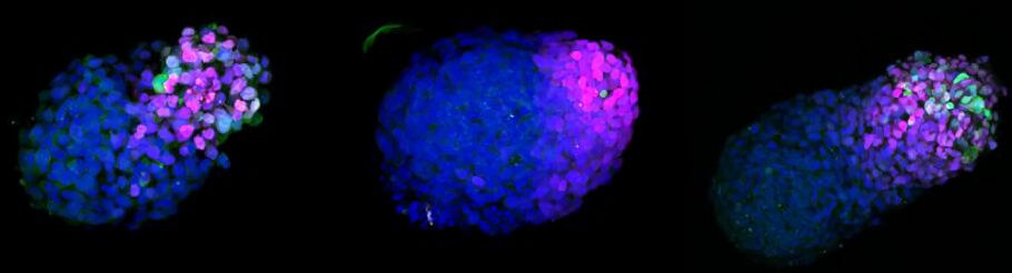 DisabledWorld's tweet image. New Ethical Framework Introduced for #StemCell Based Embryo Research
#CodeofPractice for the Generation and Use of #HumanStemCell Based #Embryo Models - #SCBEM Code of Practice
disabled-world.com/news/research/…