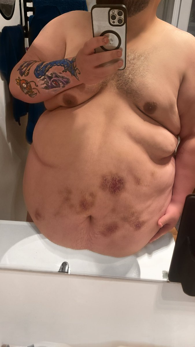 Bearish_One's tweet photo. Last night was a bit of a #rough #breeding 

#Daddy #BeardyStrong #Bears #GayBear #chasersandbears #gaygaimer #grommr #feabie #gaynz #bearoftwitter #bwc #bbc #gaymelb #chubchaser #chubby #belly #dadbod #nsfwtwtًً #gaytop #cnc #hairybear #hairygay #thicktrunktuesday #bigdick #gay https://t.co/UQQe5CDroV