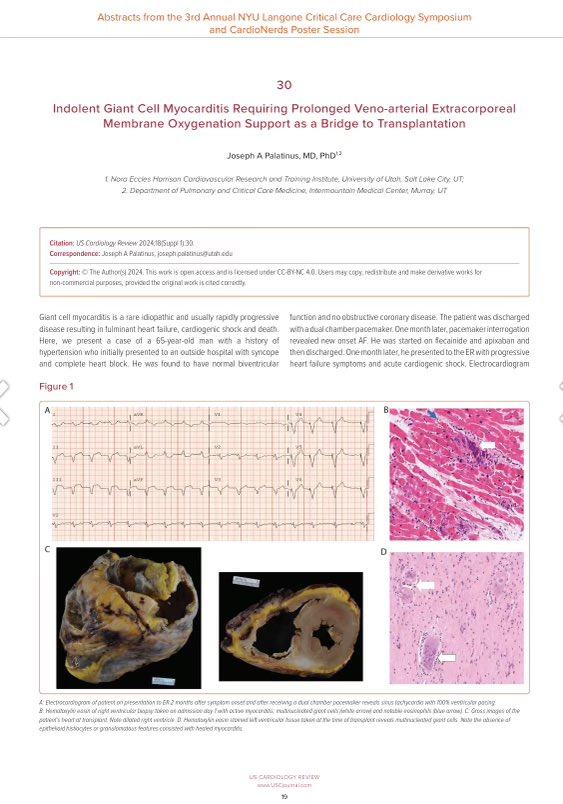 jameshorowitzmd's tweet photo. Now live @radcliffeCARDIO! 

Read the abstracts from 3rd @nyulangone @CardioNerds critical care cardiology symposium poster session! #critcarecards24 

And get ready for more this fall! Oct 25/26 

https://t.co/DJUYGYCYjS

@AmitGoyalMD @ChrisBarnettMD @AnnGageMD @CardsNYC https://t.co/HkWaWdjtHr