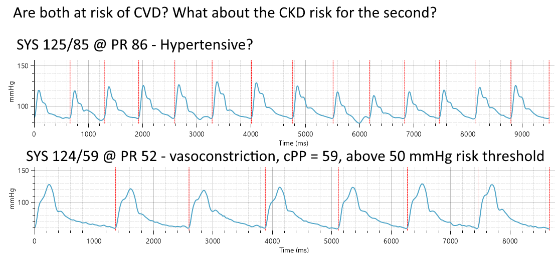 Uscom BP+ Pulse Wave Analysis tweet media