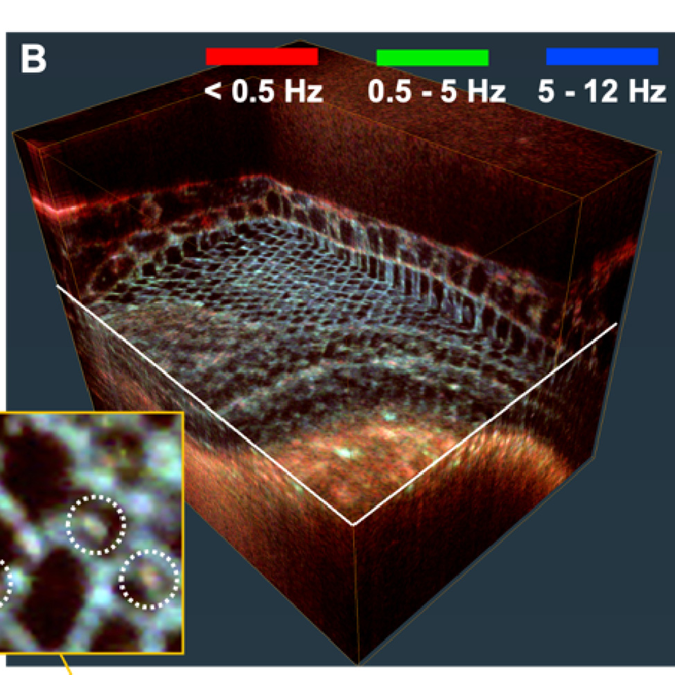 Via #OPG_BOEx: Line-field dynamic optical coherence tomography platform for volumetric assessment of biological tissues ow.ly/l9ts50StJoe #BiomedicalImaging @USWaterloo