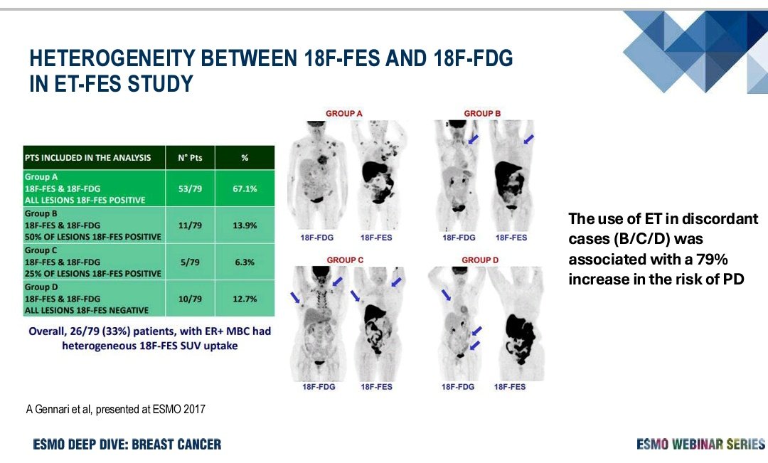 SuyogCancer's tweet photo. 18F- FES PET/CT . 
18F- Fluroestradiol PET as a predictive diagnostic marker for endocrine sensitivity in patients treated with ET in MBC . 
Already FDA approved in 2023   . Are we   routinely doing it ?  @myESMO #ESMODeepDive https://t.co/JsOuGS2sZq