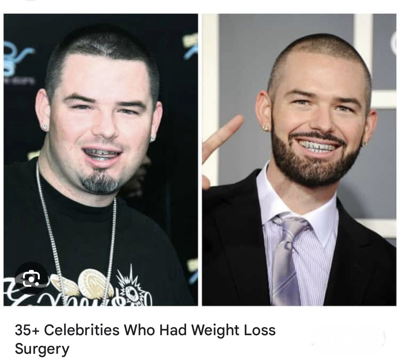 Paul Wall Weight Loss Weight Loss: Man, 57, Sheds 3.2st After Doctor's