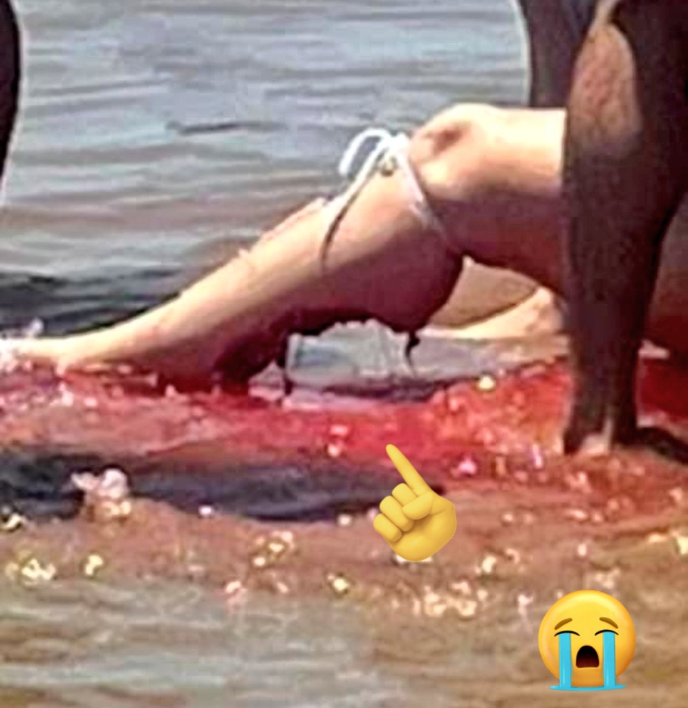 LaticiaD's tweet image. A #Shark bites a woman at #SouthPadre Island 
#Texas 
#FourthOfJuly