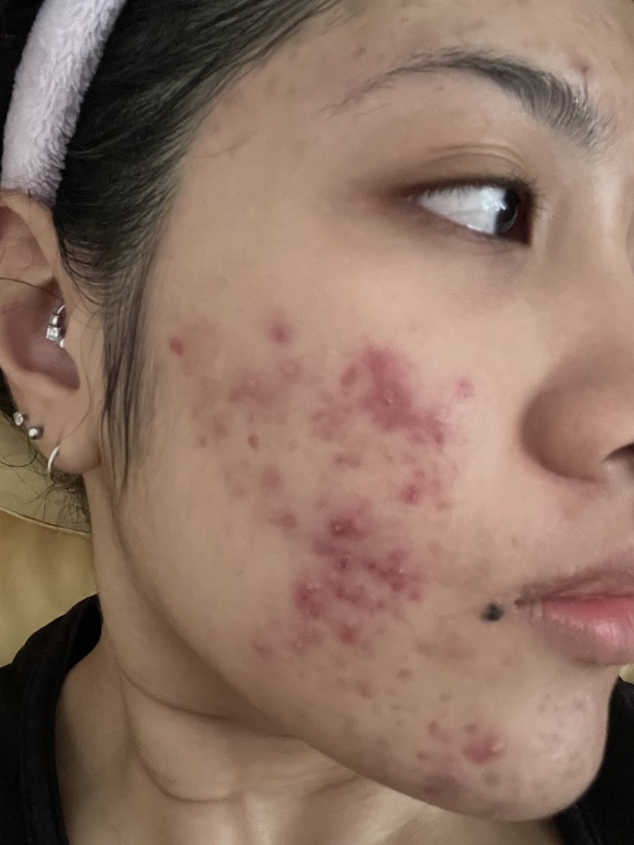 yanaazmill's tweet photo. NEVER BACK DOWN, NEVER WHAT?
NEVER GIVE UP🗣️🗣️🗣️
Ngl, my skin really LOVE this one brightening serum that I've been using for the past 2 weeks😭🫶🏻
#BerryBeautiful #ippuniReview https://t.co/mdDv5Szz7H