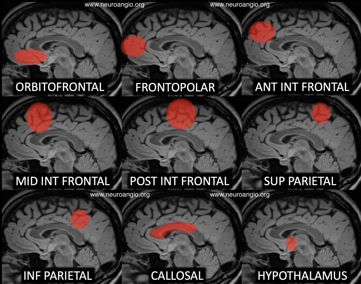 The territories of the #AnteriorCerebralArtery <a href="/neuroangio1/">Neuroangio</a>