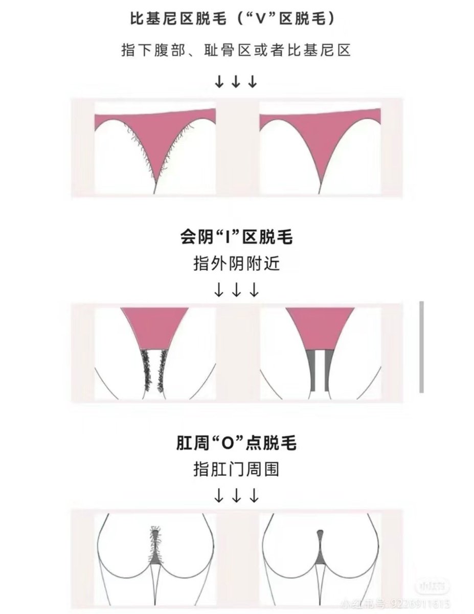 12baegirl's tweet photo. 男生脱毛攻略
所有脱毛方式 我个人最推荐激光脱毛
唯一的缺点就是价格略高（脱完2000-3000元 一年半）
1. 你们在美团搜男士VIO脱毛  不要搜“私处脱毛”（出来的可能是隐藏服务
2. 可以分区脱 VI区比较建议脱掉 O区看个人喜好
3. 仪器的选择如图三 个人觉得赛诺龙和飞顿的最好用
4.还有问题评论问我 https://t.co/012UoAgwso