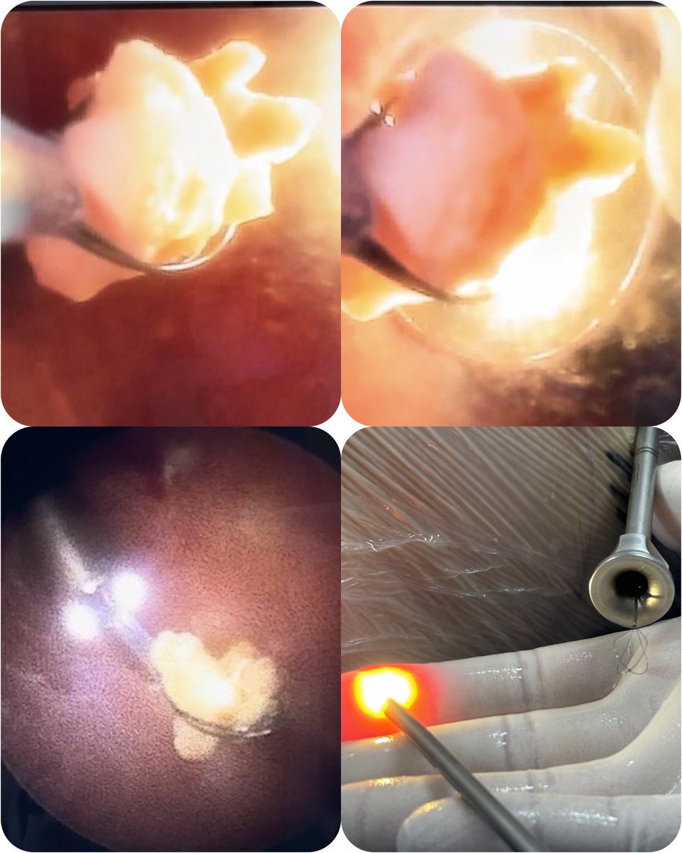 Guided by the light! 
<a href="/endouroacademy/">Endourology Academy</a> <a href="/young_endosoc/">Young Endo Society</a> <a href="/sbuoficial/">Sociedade Brasileira de Urologia</a> <a href="/so_uro/">UroSoMe</a>