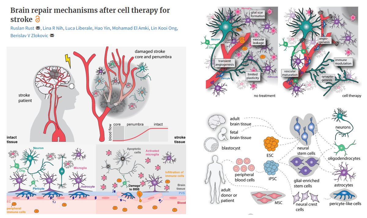 Happy to have contributed a small part to this well-composed <a href="/Brain1878/">Brain</a> review 😆

Brain repair mechanisms after cell therapy for #Stroke

Cell sources -/+ genetic engineering
▶️#NeuralStemCell
▶️#hiPSC-derived neural or vascular progenitors
▶️Cerebral #Organoid

Direct