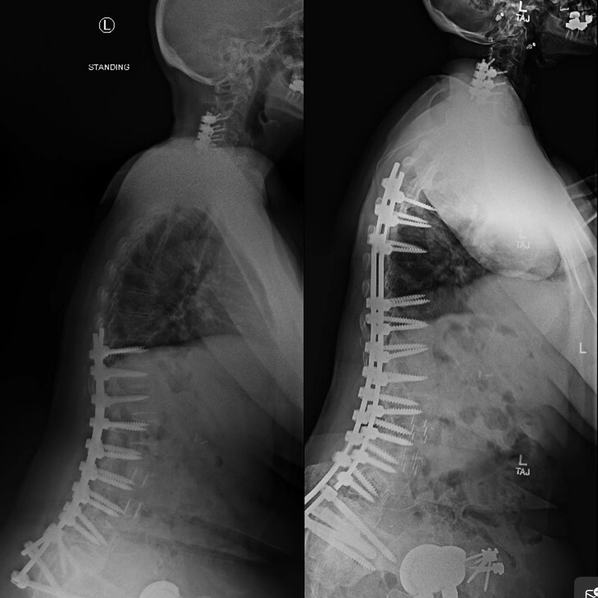 Andrew J. Grossbach, MD, FAANS tweet media