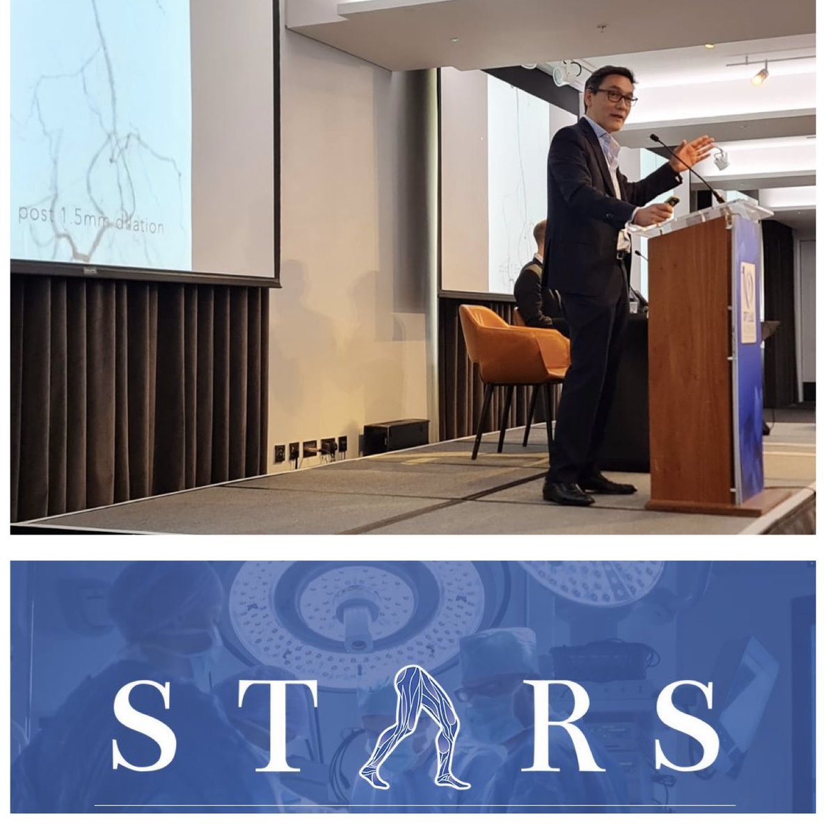 August Ysa (@ysaaugust) on Twitter photo Really honored to have been part of the 10th Anniversary of the STARS conference in London. Great extreme BTK revascularization session. Many thanks <a href="/EndovascularU/">Hany Zayed</a> for your kind invitation! 🤗 Really honored to have been part of the 10th Anniversary of the STARS conference in London. Great extreme BTK revascularization session. Many thanks <a href="/EndovascularU/">Hany Zayed</a> for your kind invitation! 🤗