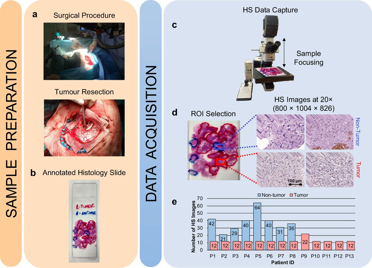 The recently published "Histological Hyperspectral Glioblastoma Dataset (HistologyHSI-GB)" dataset contains 13 H&amp;E slides (20x magnification) from glioblastoma subjects which were annotated and used to create 469 hyperspectral images: doi.org/10.7937/Z1K6-V…