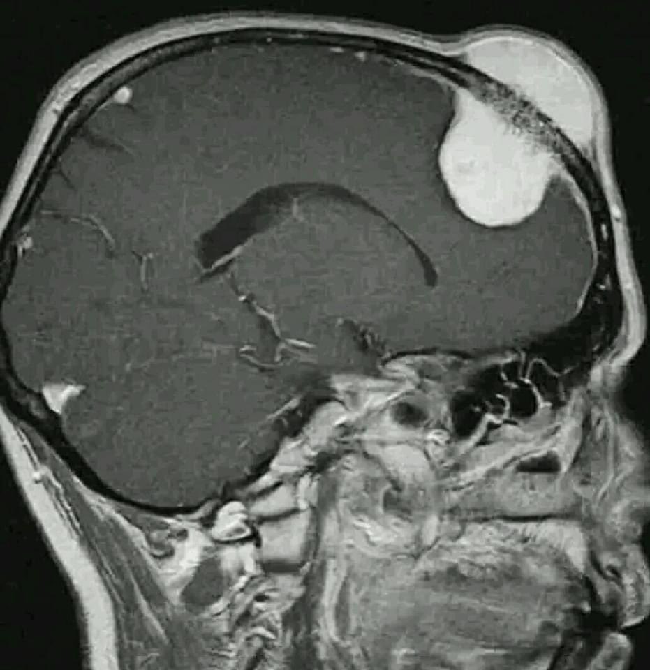 hemo_shk's tweet image. #findings
#diagnosis

What is your diagnosis?

#MedEd 
#MEDHM 
#MedX 
@IhabFathiSulima