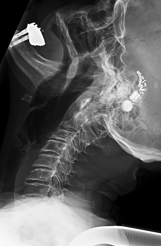 UW MSK Imaging & Intervention tweet media