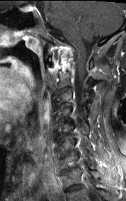 UW MSK Imaging & Intervention tweet media