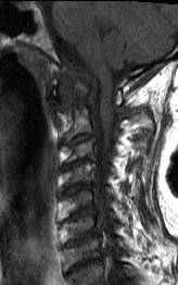 UW MSK Imaging & Intervention tweet media
