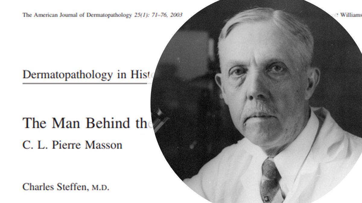 Pierre Masson, chair of the depart of pathology at Montreal (1927-1954), inventor of novel stains –Masson trichrome, silver stain, keen observer of tumors and cell of origin: the glomus tumor, nevi, carcinoid tumor, remembered as a modest man yet a giant of surgical pathology.