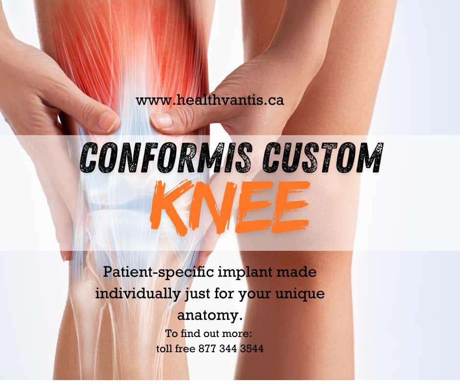 Conformis knee makes a knee replacement implant designed just for you. Find out if this may be a better option for your private knee replacement. #conformiskneereplacement #nowaiting #qualityoflife healthvantis.ca/2024/05/22/pri…