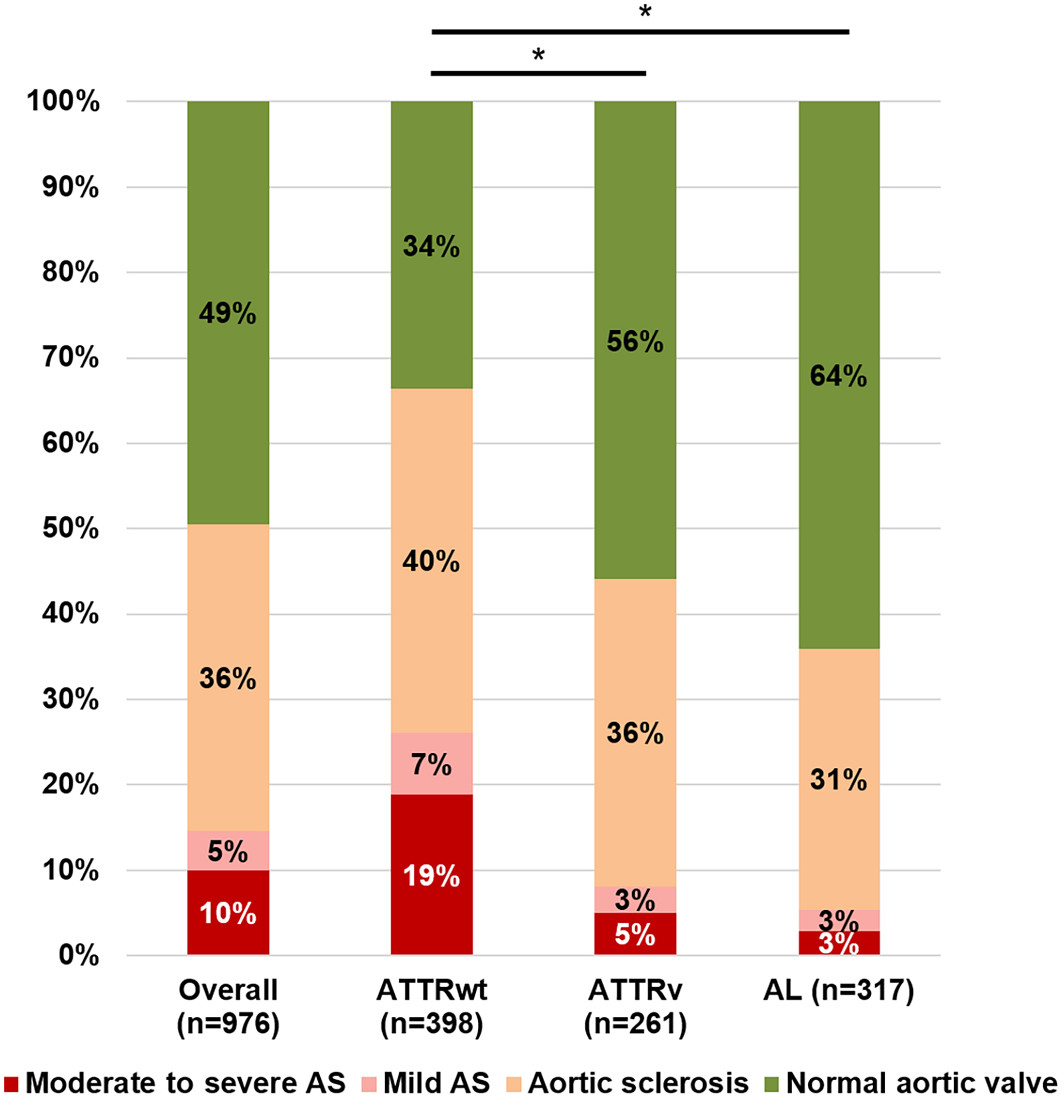 JAHA (@jaha_aha) on Twitter photo In cardiac amyloidosis patients, 15% had aortic stenosis (AS). ATTRwt patients (26% AS) should be screened for AS. #AHAJournals <a href="/ClavelLabo/">Labo Dr Clavel</a> <a href="/IUCPQ/">IUCPQ-ULaval</a> <a href="/universitelaval/">Université Laval</a> ahajrnls.org/3xJpWtK In cardiac amyloidosis patients, 15% had aortic stenosis (AS). ATTRwt patients (26% AS) should be screened for AS. #AHAJournals <a href="/ClavelLabo/">Labo Dr Clavel</a> <a href="/IUCPQ/">IUCPQ-ULaval</a> <a href="/universitelaval/">Université Laval</a> ahajrnls.org/3xJpWtK