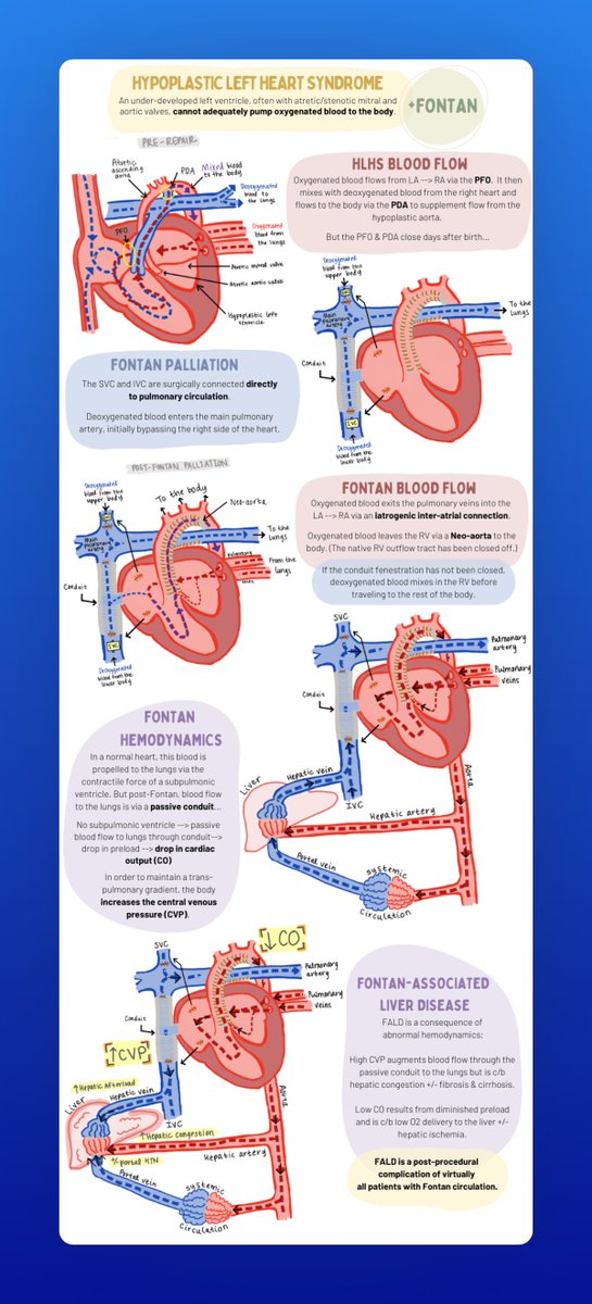Kate Alta 👩🏼🦰 (@katealtawilcox) on Twitter photo Pictures make everything in #ACHD better- Let's learn about #Fontan anatomy using hypoplastic left heart syndrome ( #HLHS ) as an example! <a href="/ClaireCambron/">Claire Cambron</a> made some INCREDIBLE infographics to break it down for us: Pictures make everything in #ACHD better- Let's learn about #Fontan anatomy using hypoplastic left heart syndrome ( #HLHS ) as an example! <a href="/ClaireCambron/">Claire Cambron</a> made some INCREDIBLE infographics to break it down for us: